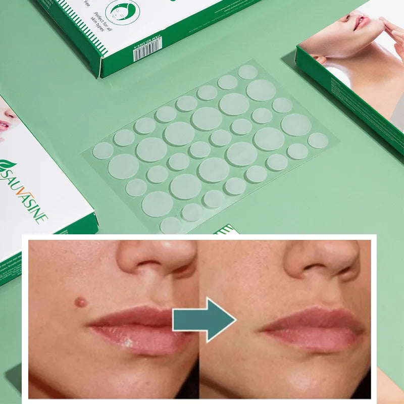NEW SKIN TAG REMOVER PATCHES NATURAL UK