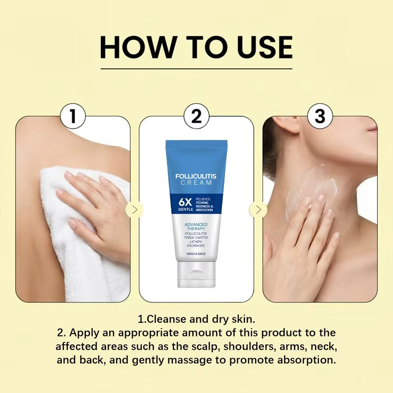 Folliculitis Treatment Cream: Effective Treatment for Folliculitis Scalp,100g/1x