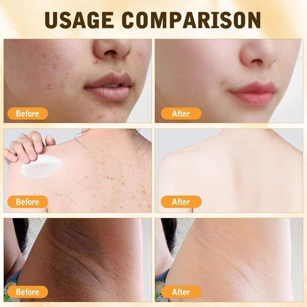 2PCS Bee Venom Comprehensive Cream, Natural Skin Moisturizer, 2025 New Bee...
